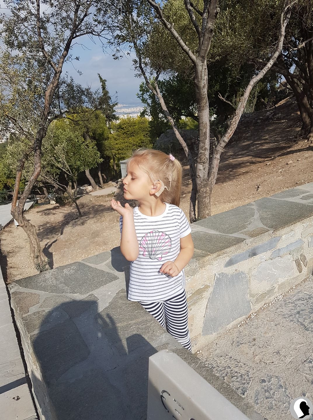 CI Kopf 2018 weiblich Kind